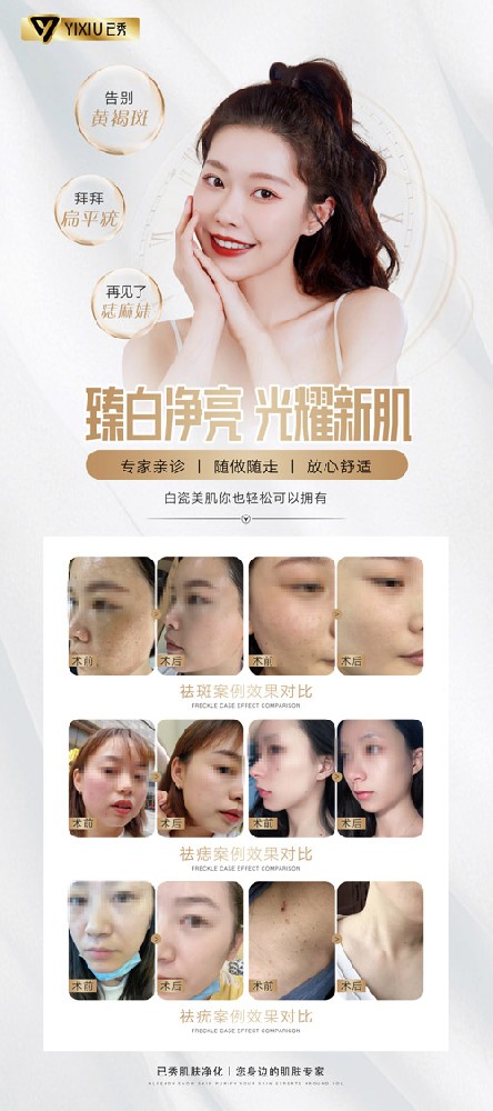 已秀瘦身招商减肥合作